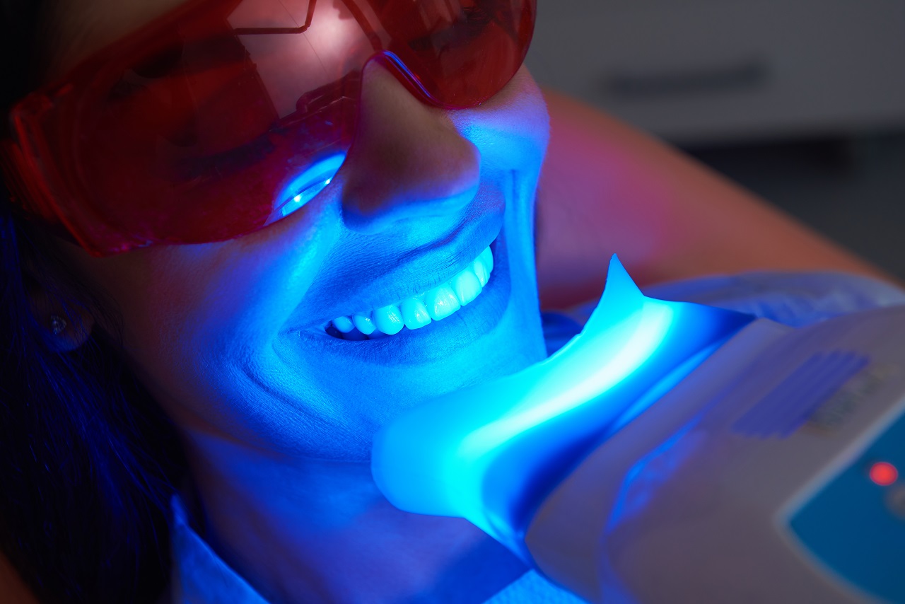 Jakimi sposobami wykonuje się zabieg wybielania zębów?